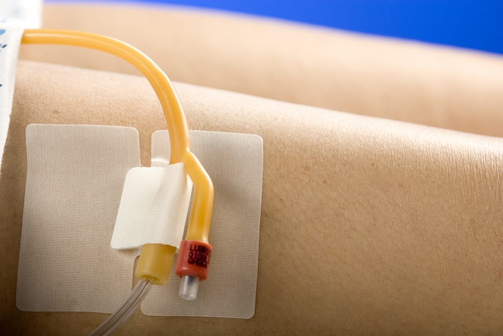 MC Johnson CATHSECURE® MultiPurpose Tube Holder Bowers Medical Supply