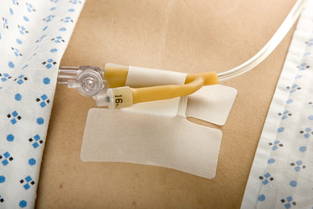 MC Johnson CATHSECURE® MultiPurpose Tube Holder Bowers Medical Supply