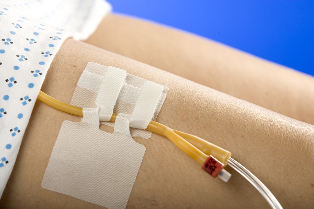 MC Johnson CATHSECURE DUAL TAB® MultiPurpose Tube Anchoring Device Bowers Medical Supply