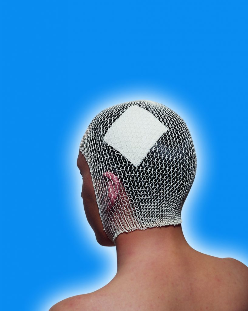 FRA SURGIFIX® Tubular Elastic Net Bandage Bowers Medical Supply