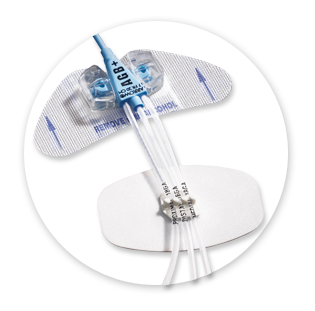 Image of Bard Medical StatLock® CV Plus Stabilization Device